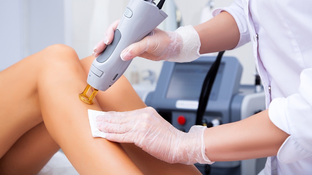 A Local’s Guide to Laser Hair Removal in Monroe County, NY