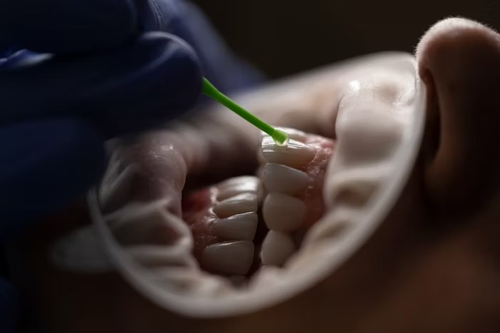 The Rise of Cosmetic Dentistry
