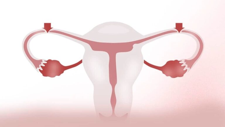 Midwest Fertility Center – Your Trusted Choice for Tubal Reversal in St. Louis